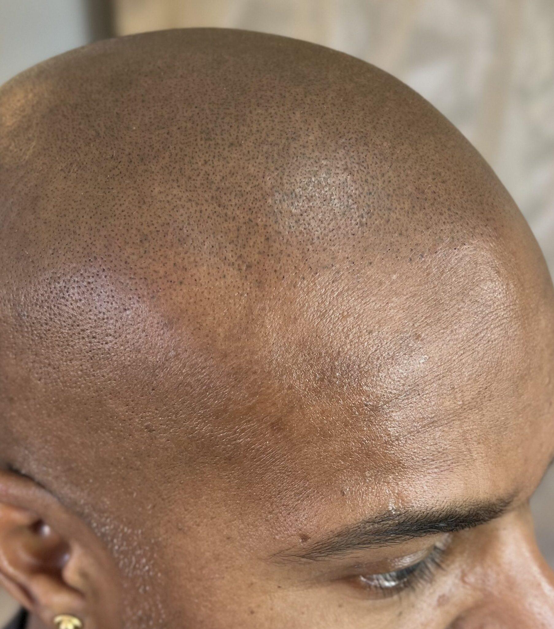 effet densité naturel sur peau noire