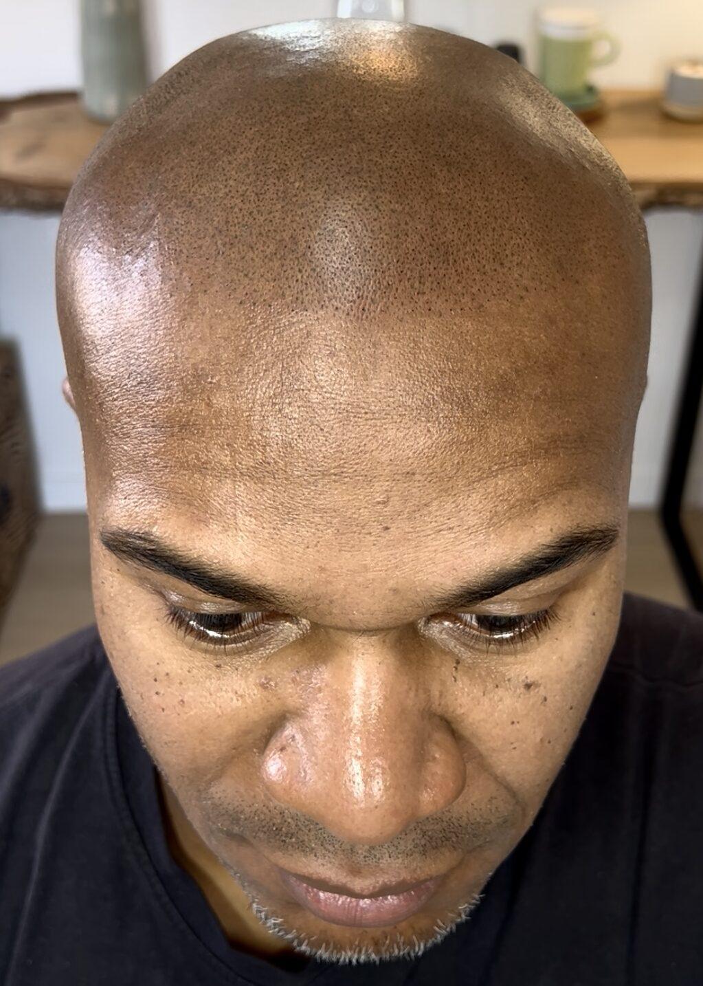 effet rasé naturel sur calvitie homme peau noire
