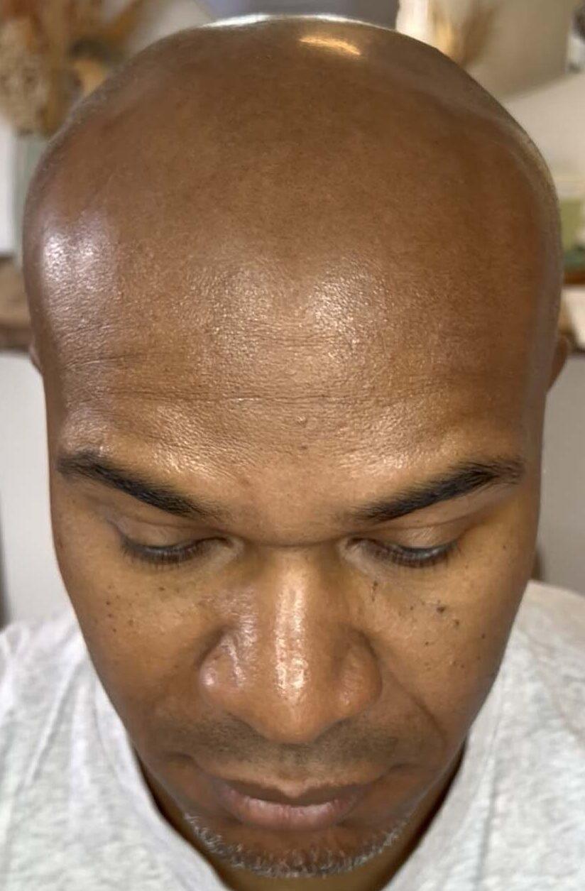 résultat avant tatouage capillaire sur homme peau noire