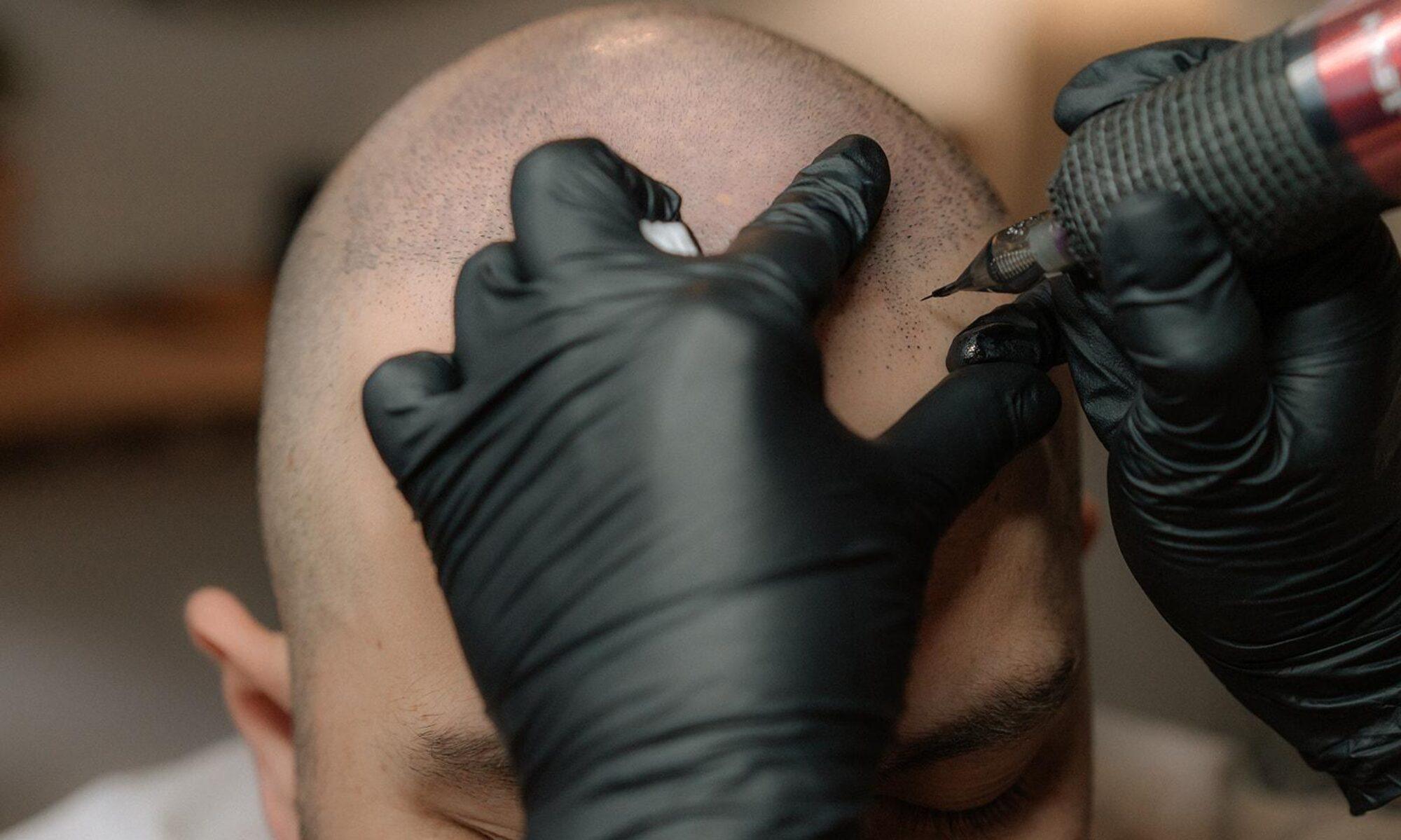 une photo d'une tatoueuse qui fait une tricopigmentation