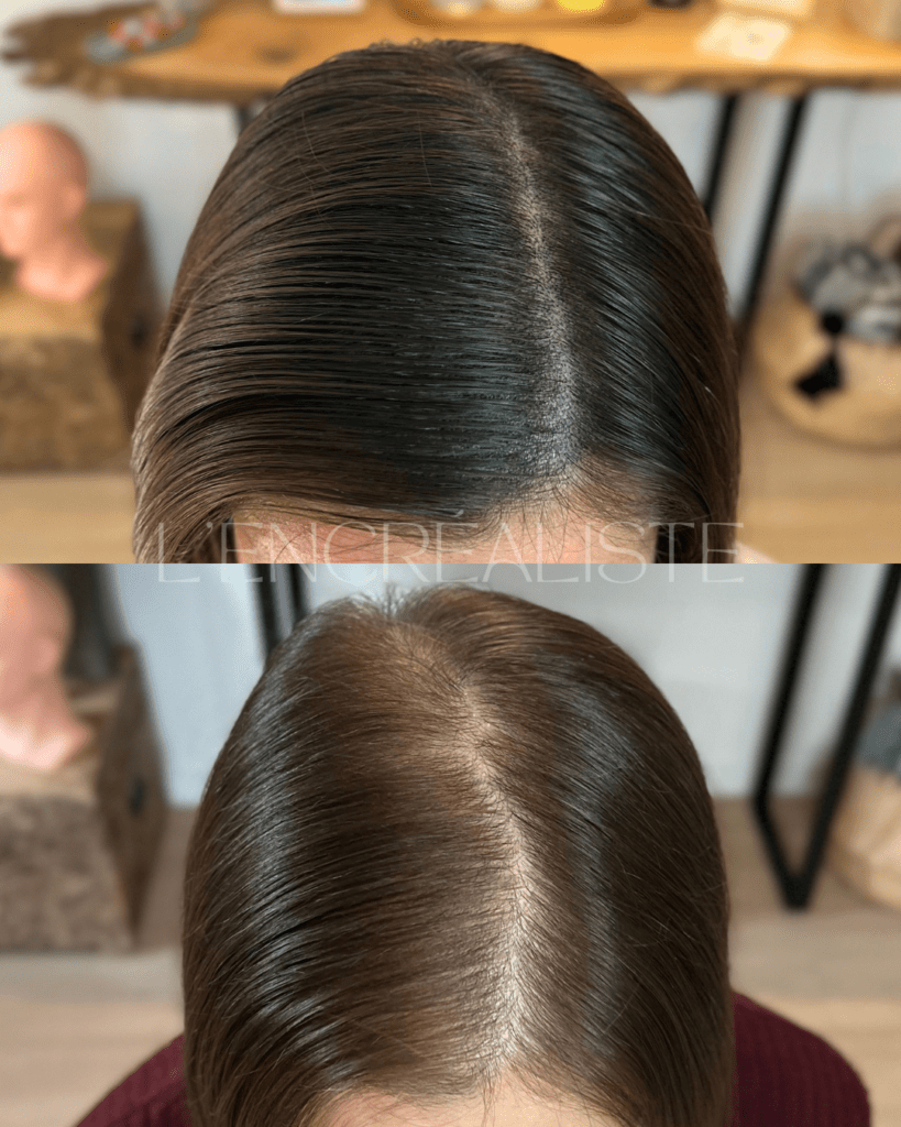 Photo avant après une tricopigmentation réalisée à Bordeaux sur une femme pour restaurer la densité capillaire. La zone traitée apparaît plus uniforme, avec un effet naturel qui imite parfaitement le cheveux et redonne confiance et harmonie. nouvelle aquitaine gironde mérignac talence pessac bègles